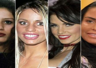 8 celebrities που σίγουρα μετάνιωσαν την πλαστική τους επέμβαση