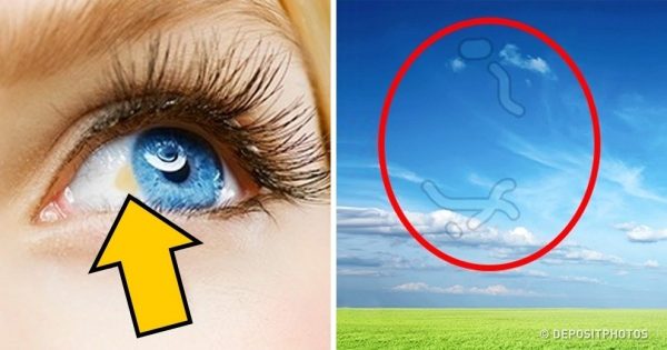 12 σημάδια που εμφανίζουν τα μάτια μας όταν έχουμε πρόβλημα με την υγεία μας